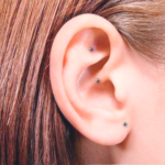 que es la auriculoterapia, imagen de oreja con estimulos en la aurícula